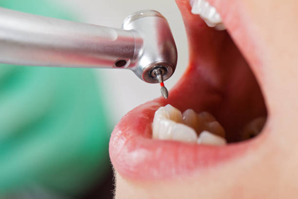 Best Emergency Gum Pain Relief  in Sharpsburg, NC